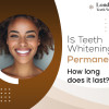 Wondering how long teeth whitening lasts? Learn about its duration, factors affecting results, and tips to maintain a brighter smile for longer.